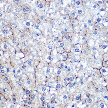 HILPDA Antibody