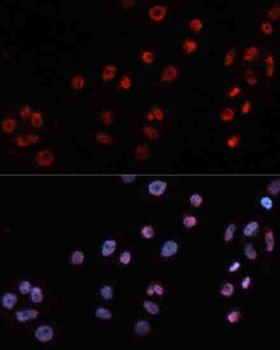 MT2A Antibody