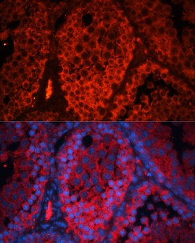 Kctd19 Antibody