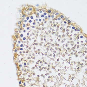 C12orf10 Antibody