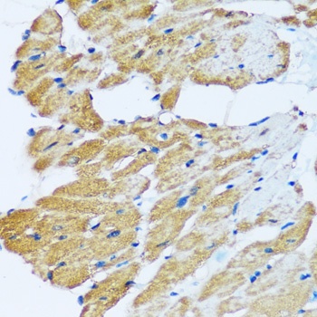 ARHGEF5 Antibody