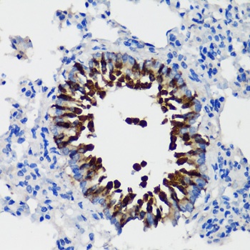 SCGB1A1 Antibody