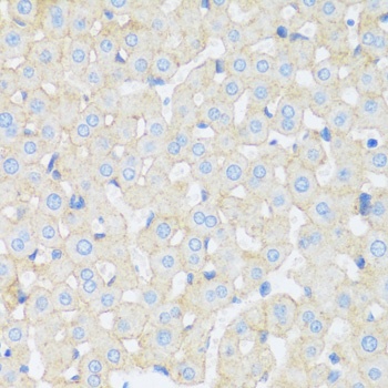 ASGR1 Antibody