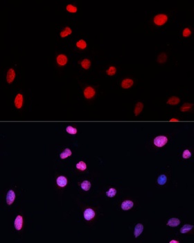 ERCC5 Antibody