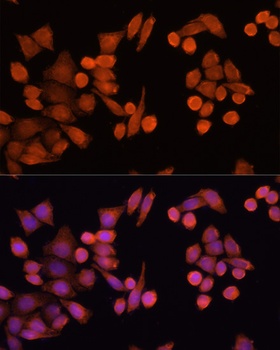 PLA2G4D Antibody