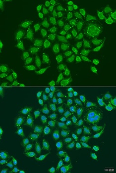 PRDM10 Antibody