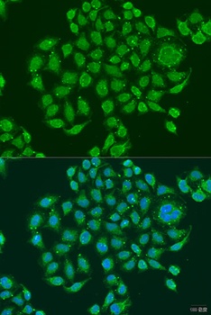 PRDM10 Antibody