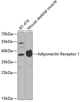 ADIPOR1 Antibody