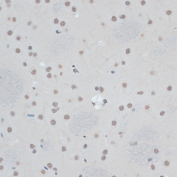 ZNF433 Antibody