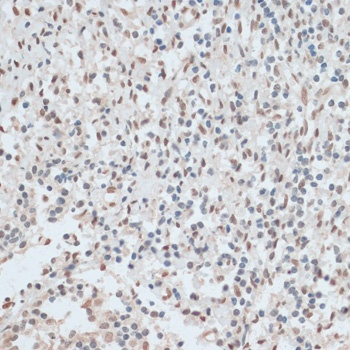 ZNF574 Antibody