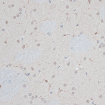 ZNF415 Antibody