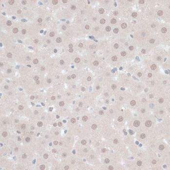 ZNF446 Antibody