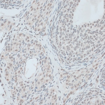 ZNF416 Antibody