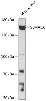 SEMA5A Antibody