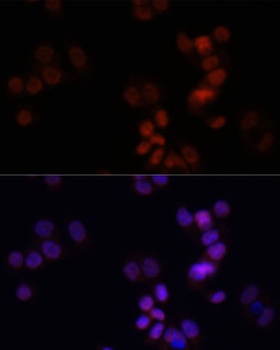 KDM7A Antibody