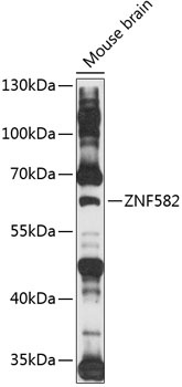 ZNF582 Antibody