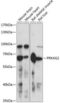 PRKAG2 Antibody