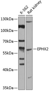 EPHX2 Antibody