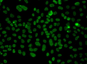 PLCXD2 Antibody