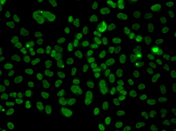 PLCXD2 Antibody