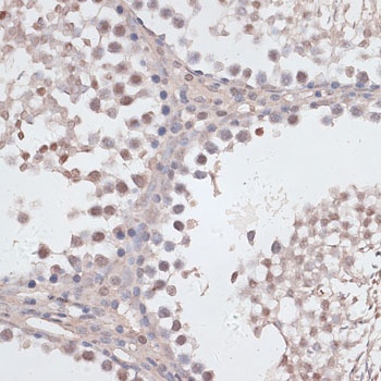 CCNE2 Antibody