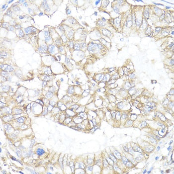 ATP1B1 Antibody