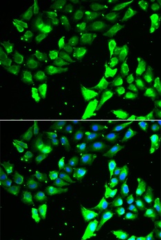 KIF2B Antibody