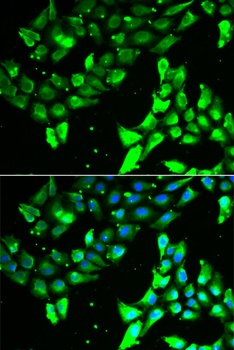 KIF2B Antibody