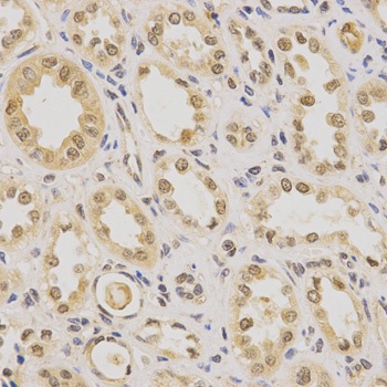 PDHA1 Antibody