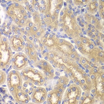 IL12RB1 Antibody