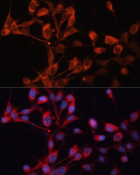 SLC25A19 Antibody