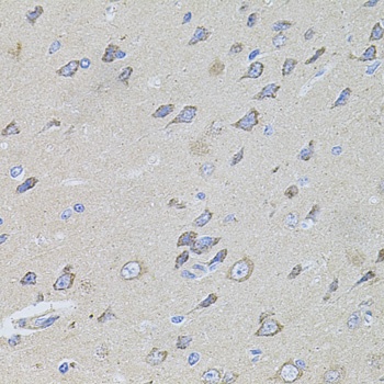 WISP2 Antibody