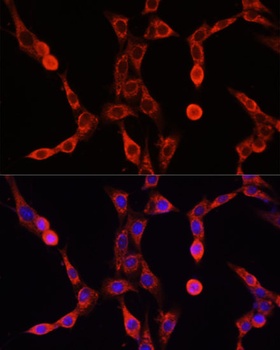 ABCD1 Antibody