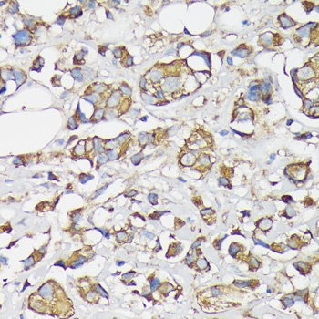 KRT7 Antibody