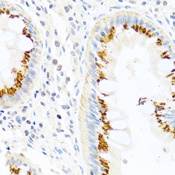 FAM3B Antibody