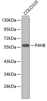 P4HB Antibody
