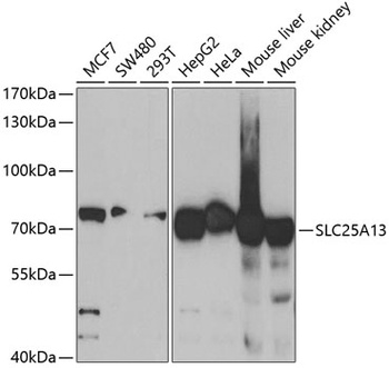 SLC25A13 Antibody