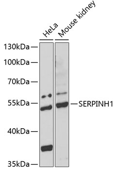 SERPINH1 Antibody