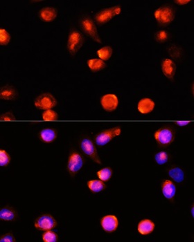 ABCA4 Antibody