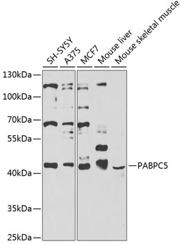 PABPC5 Antibody