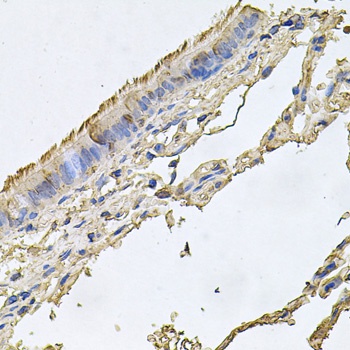 FABP12 Antibody