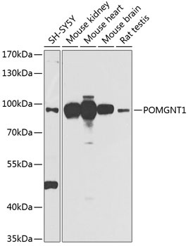 POMGNT1 Antibody