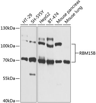 RBM15B Antibody