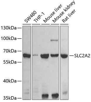 SLC2A2 Antibody
