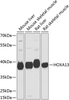 HOXA13 Antibody