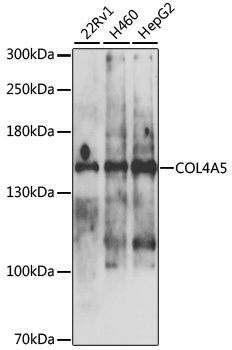 COL4A5 Antibody