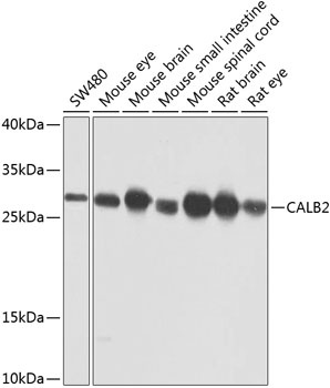 CALB2 Antibody