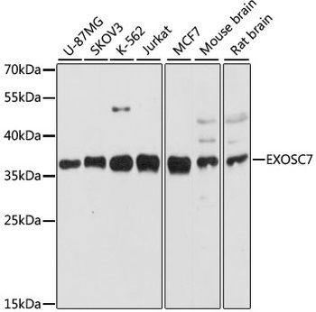EXOSC7 Antibody