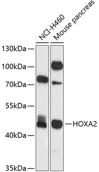 HOXA2 Antibody