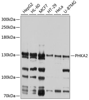 PHKA2 Antibody
